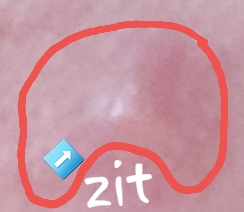 Zit